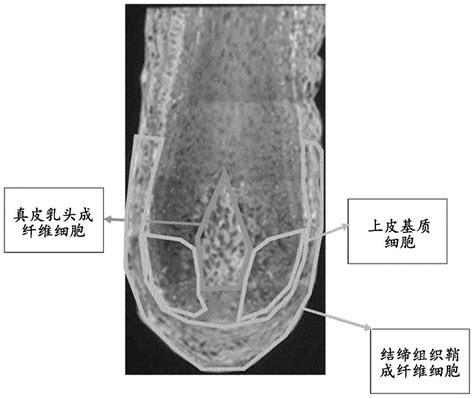 乳頭生毛|乳头毛